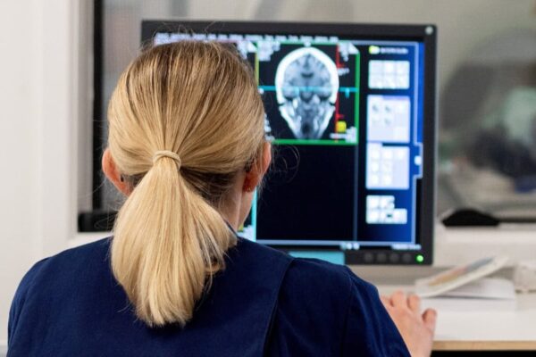 UK Biobank - brain